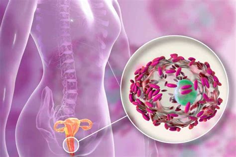 Sintomas Ng Vaginal Infection, Anu.